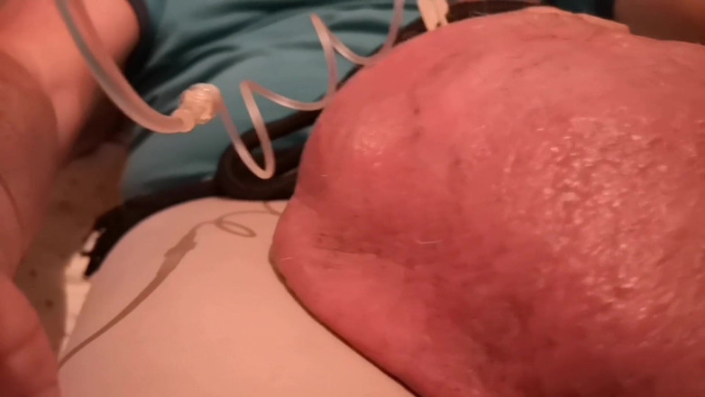 Monster_Meat_: Llenar con 0,500liter glucosa 10%
