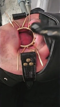 실험 준비 펨돔 본딩