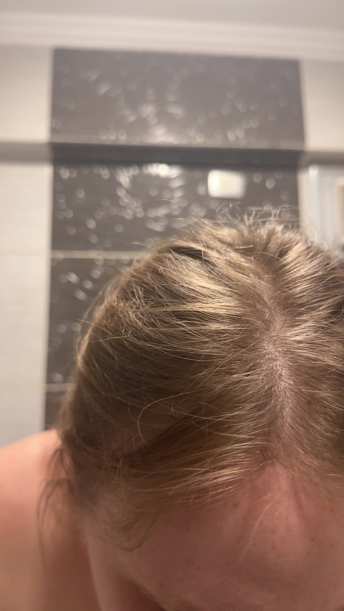 SweetLucy96: Pirang panas dengan kawat gigi