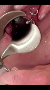 Dòng nước mạnh mẽ đi tiểu từ sự banh rộng âm hộ của tôi bởi Speculum