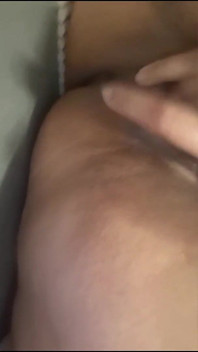 Fillers cipki