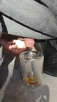Göt gıda lavmanımdan sidik ve dölleme