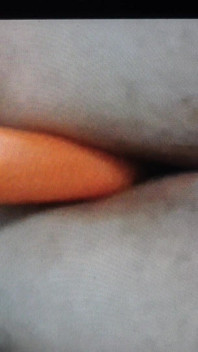 Anal Play