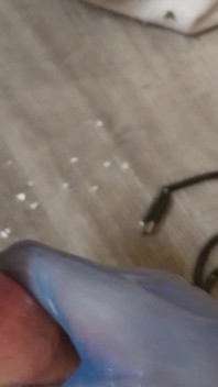 Abspritzen