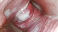 Endoscope in my pussy