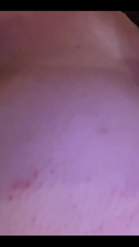 My Titties Hurt ‍
