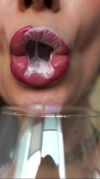 Drool Collector