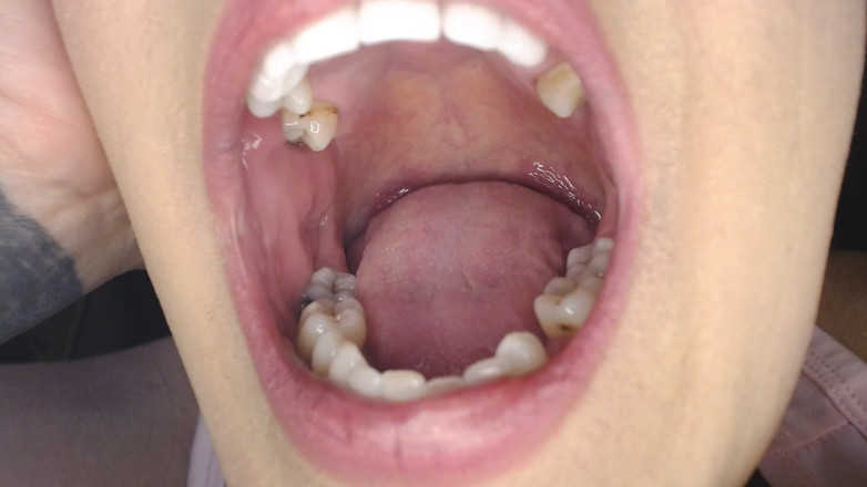 Abby Anna: Tongue Twisting Flipping Slapping Closeup Rapid Slap