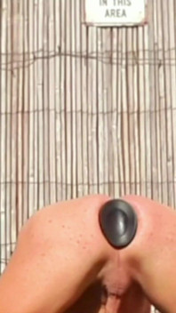 Anal esnetme