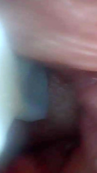 Endoskop kamera penis eğitim videosunda en hassas kısımlarını gösteriyor