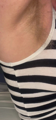 Cspot Showing Armpit Hair