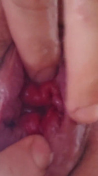 Big Gay Hole