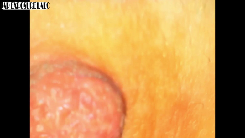 A case of fling: Asian angel 28095