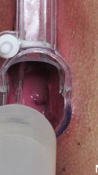 Horny Blonde with Big Meaty Pussy Fingered by Doctor