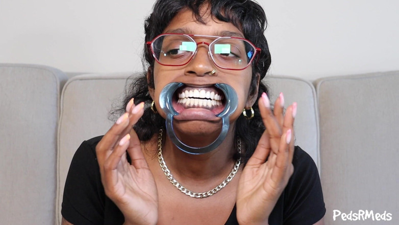 PedsRMeds: Jelajah Retraktor Gigi Youronlyphoenix