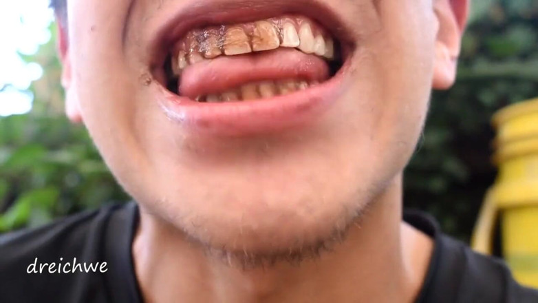 Dreichwe: Cioccolato sui denti