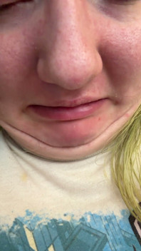 Chin Faces