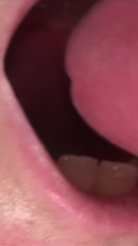 Glory Hole
