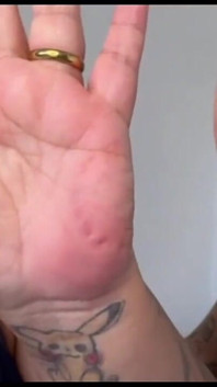 Playing with Bites