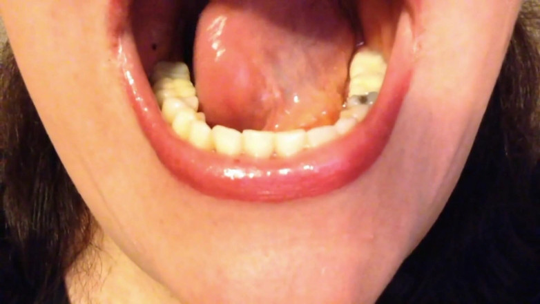 Lily Lipstixxx: Kontrola úst - Buď opatrný, koušem!