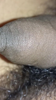 Tight Foreskin Phimosis Dick Closeup Dripping Precum Until Cum