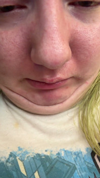Chin Faces