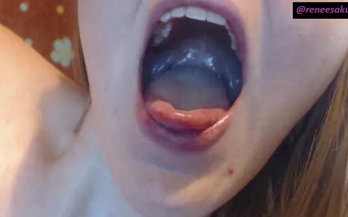 Renee Sakuya: Inside My Mouth Sore Throat