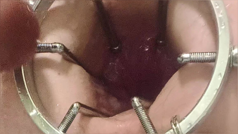 SergeyToys: Enema, chuveiro anal. Vista de close-up através do espelho anal....