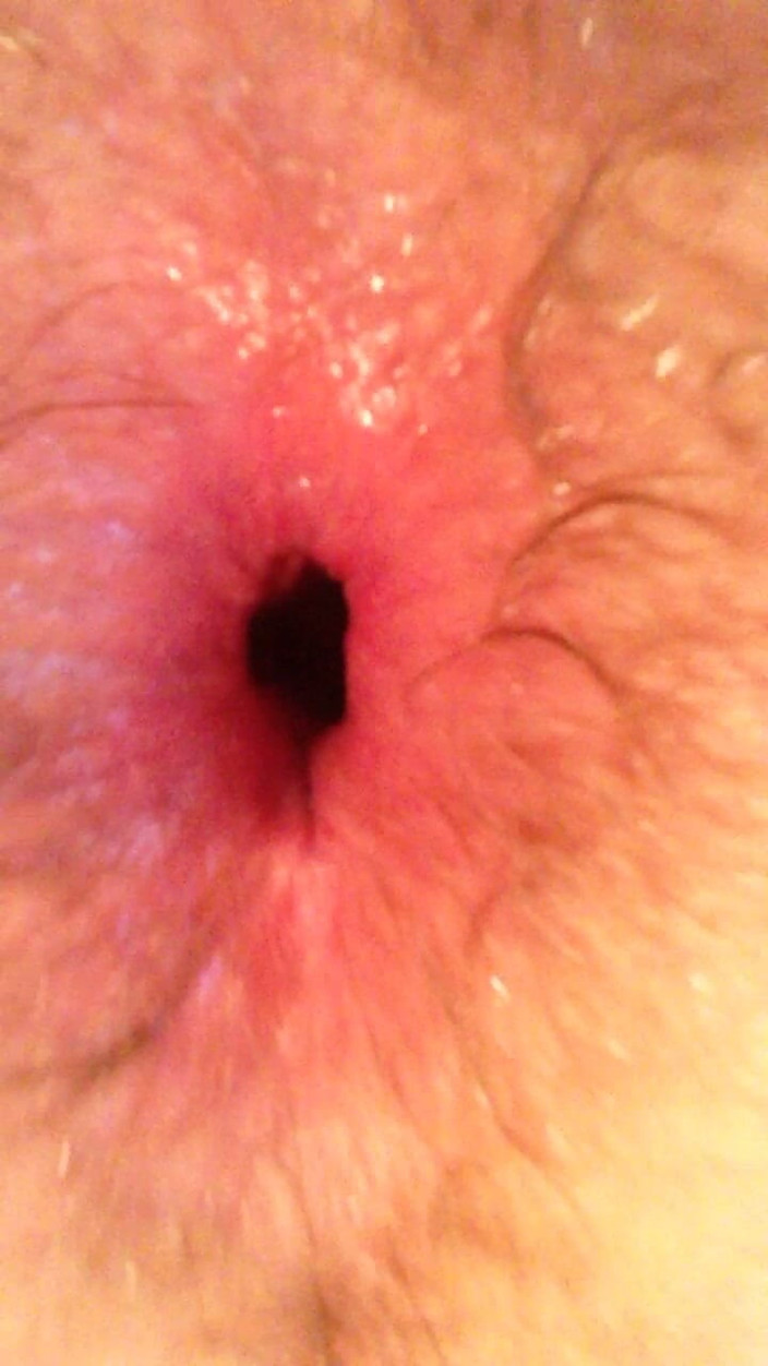 Jimmystar: Gaping My Virgin Hole