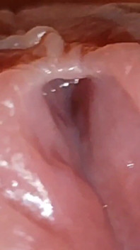 Amazing Glans with Two Cum Holes.