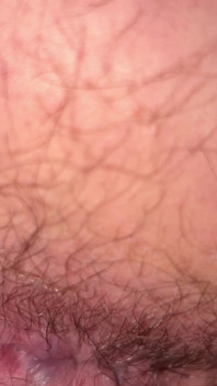 Close up Hairy Hole