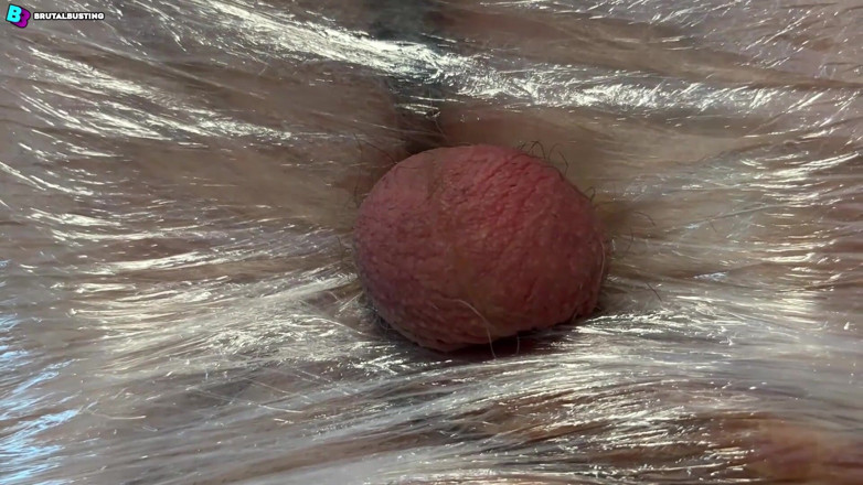 David Marcek: Testiculaire misvorming! Zijn ballen hebben geen kans om haar kracht...