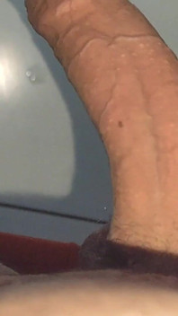 Large Deformed Cock with Lumpy Glans.