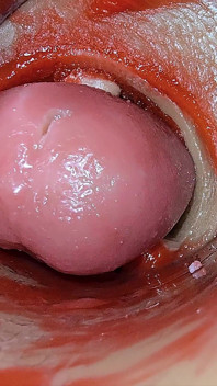 Kamera Uvnitř Hluboké Kundičky Zachycuje Předávkování Ejakulace Spermatu Asmr