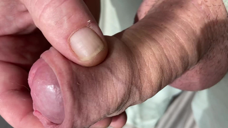 Foreskinguy: Close up mastrubatie grote onbesneden paddenstoelen pik