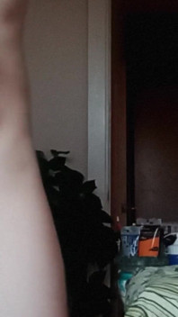 Gaping