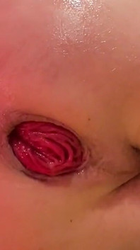 กำปั้นเจาะรูหี prolapse ที่ถูกทำลายจนอ้าปากกว้าง
