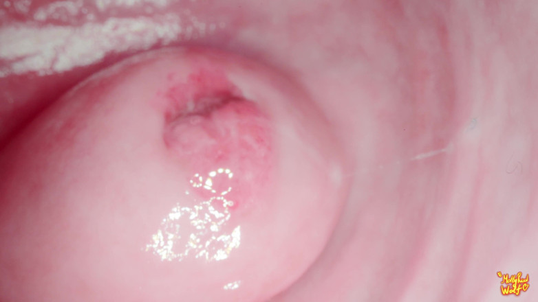 MollyRedWolf: Hai saudara tiriku! Ayo main dokter kelarang? Gyno, Endoscopy - Mollyredwolf