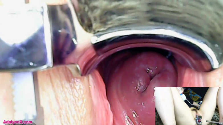 AdalynnX: Adalynnx - endoskop speculum hitachi vib