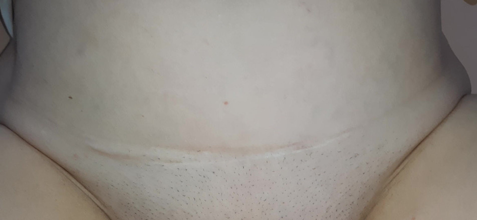 Vik_All: Ein Sehr Aufregender Reifer Pfirsich.