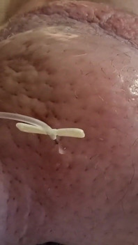 Extreme Fillings Inside My Siliconemeat