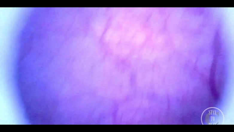 Lina Free: Magnifique à l’intérieur de ma vessie complète avec l’endoscope !