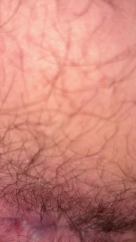 Close up Hairy Hole