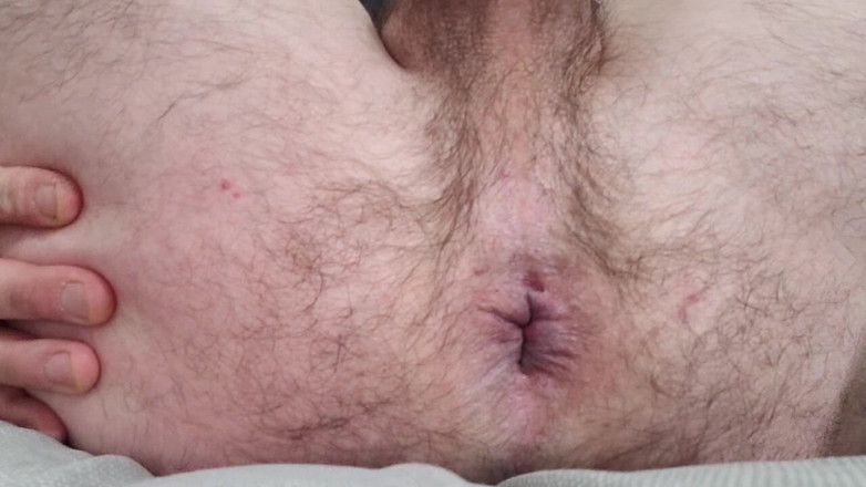 Rudedog22: Очко крупным планом