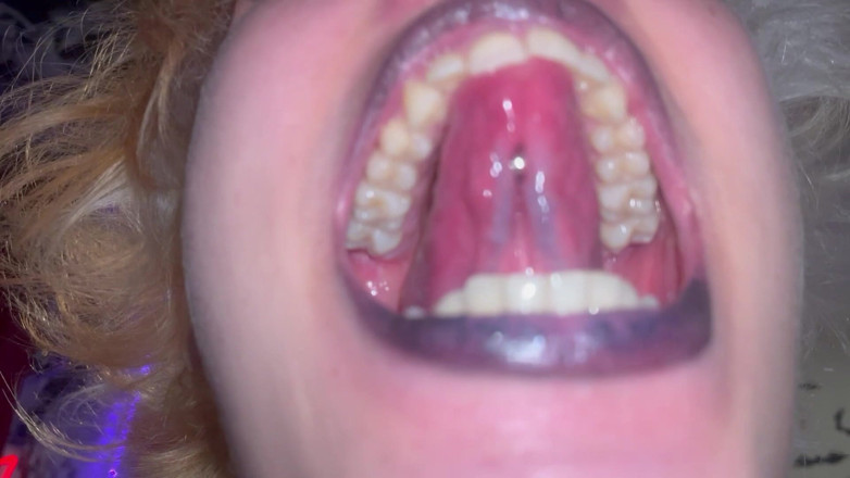Glitterqueen1999: Visite de la bouche, la gothique Uvula amygdales la langue