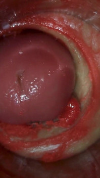 Cámara dentro del coño profundo captura enorme eyaculación de esperma asmr