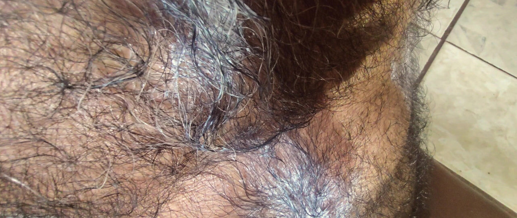 Stink HairyMale: Rất nóng ở đây
