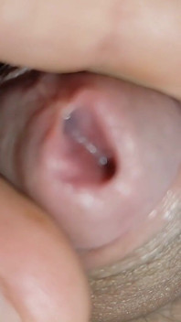 Amazing Glans with Two Cum Holes.