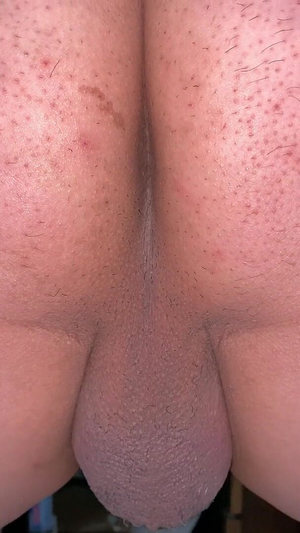 Kyotosigakk: 한 남자가 자신의 후장을 노출합니다. 주름을 선명하게 볼 수 있도록 클로즈업 샷을 찍어