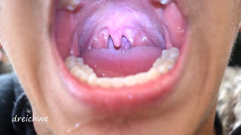 Dreichwe: Uvula fetish mouth